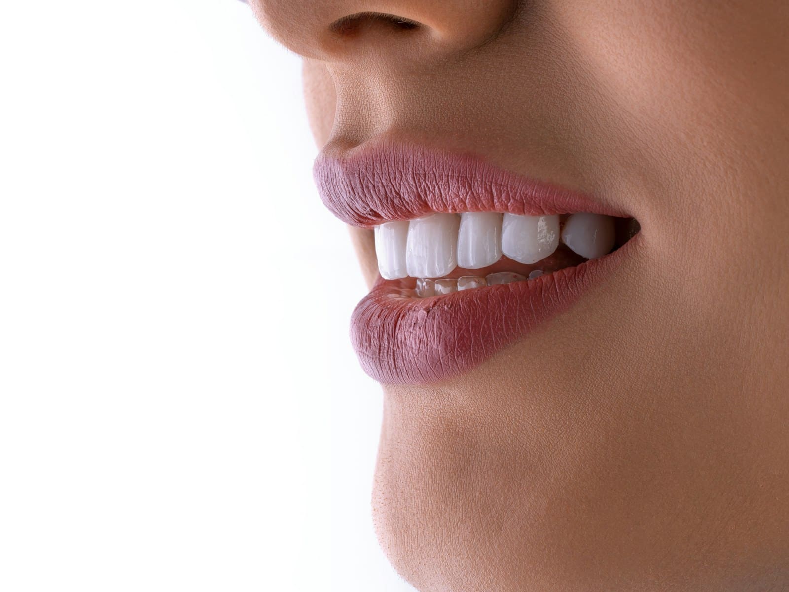 Full Smile Treatment — clinical photograph taken after treatment