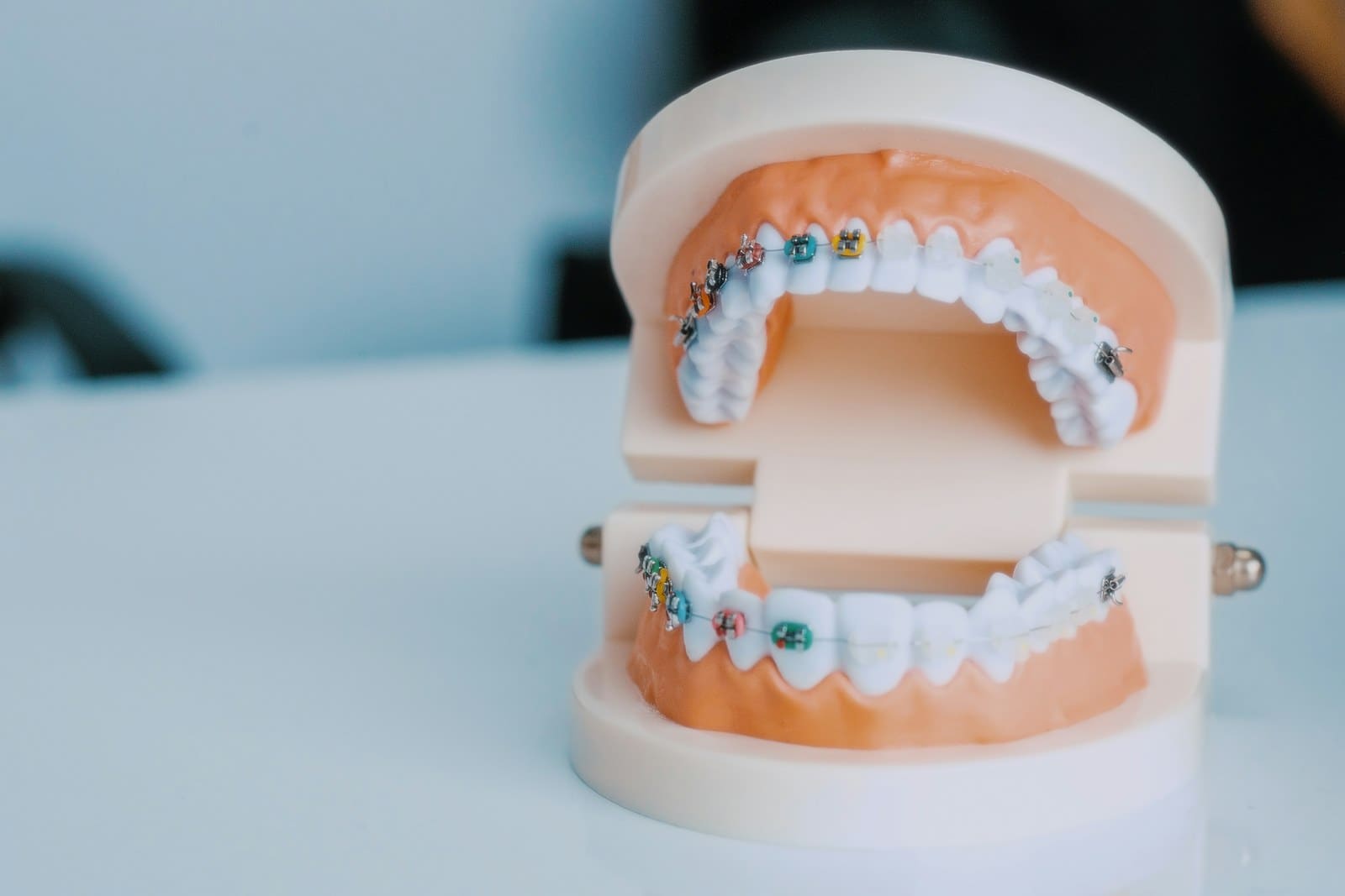 Caps & Crowns treatment at OK Dental Care Muzaffarpur