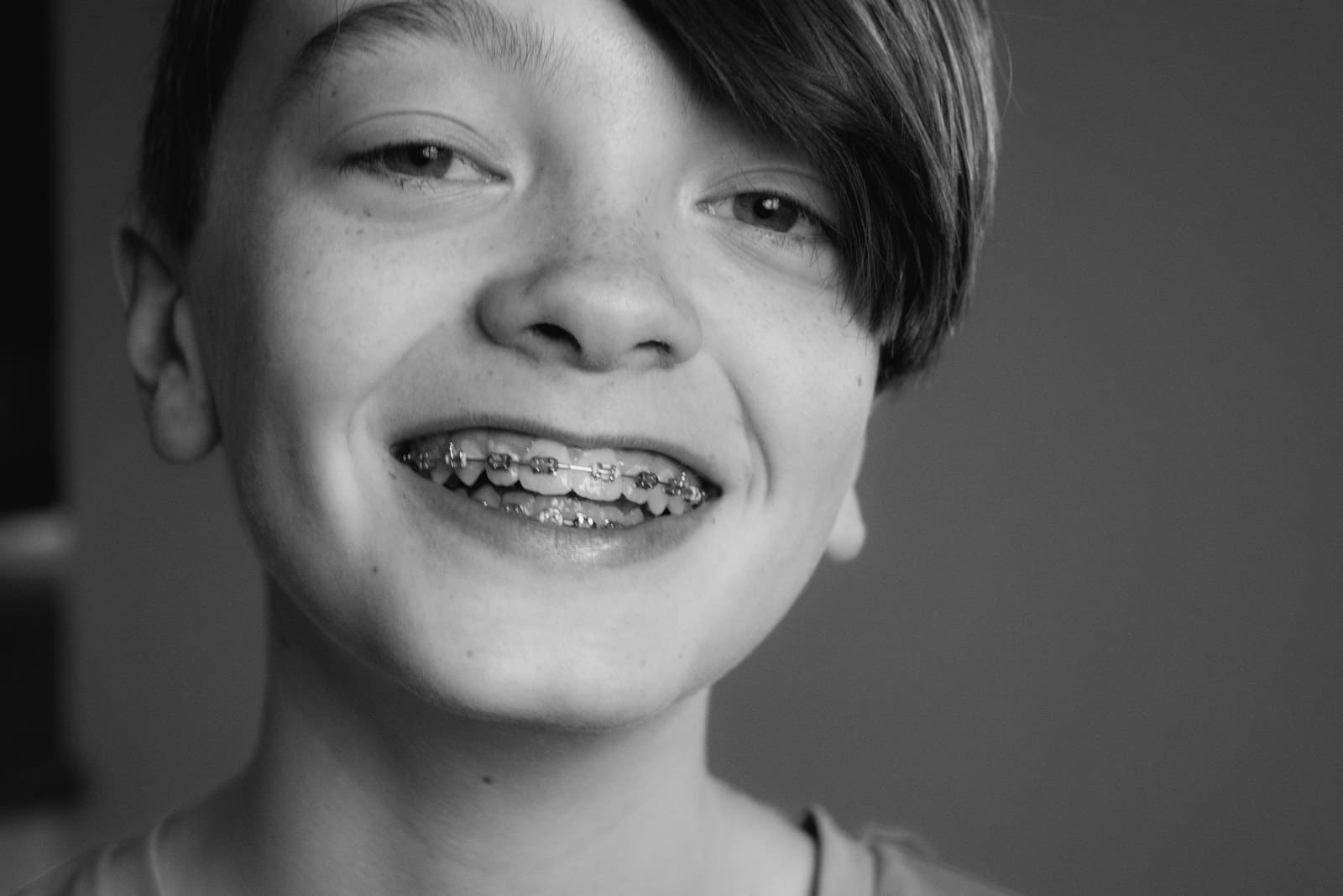 Children’s Dentistry treatment at OK Dental Care Muzaffarpur
