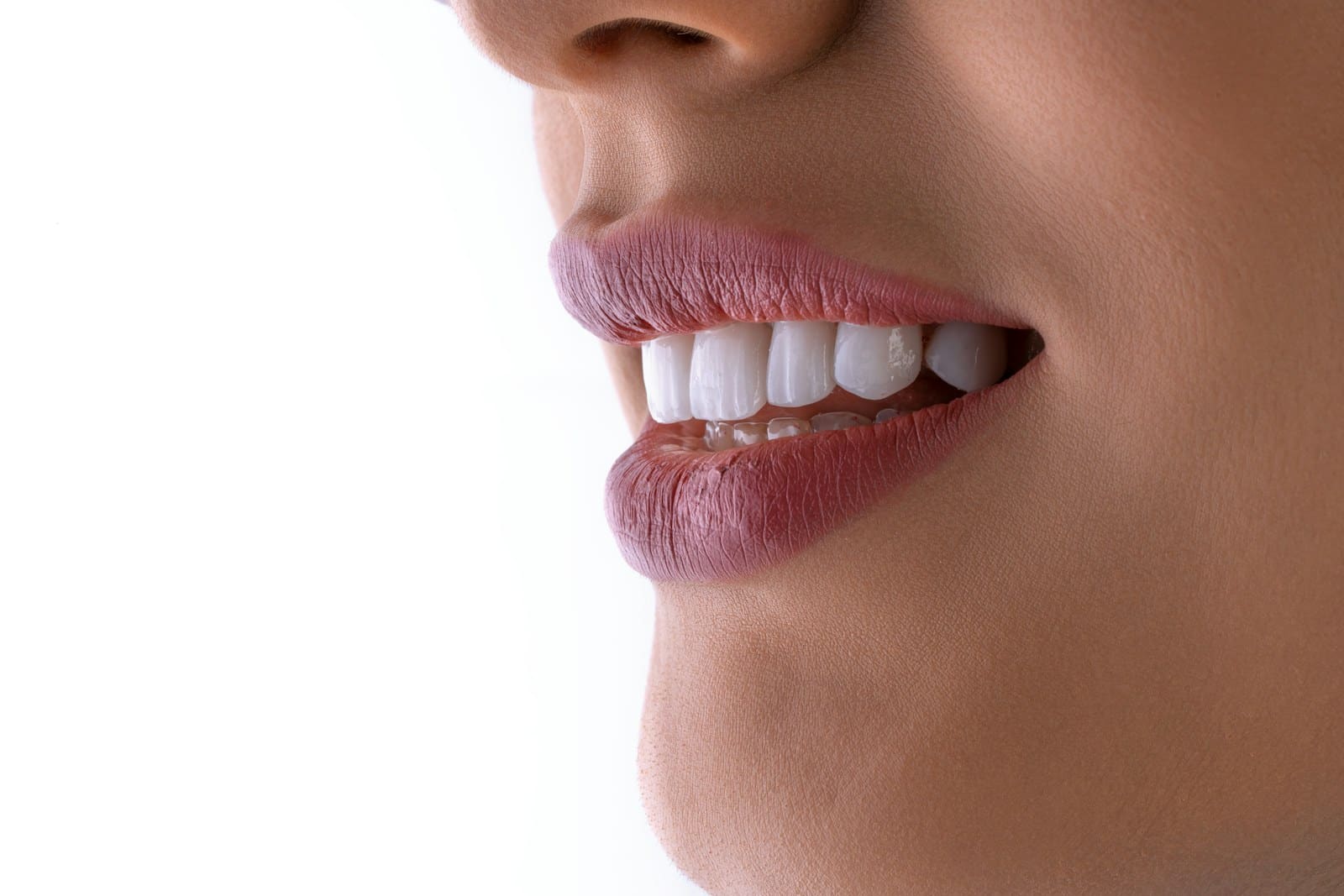 Teeth Whitening treatment at OK Dental Care Muzaffarpur